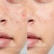 Очищающее средство для проблемной кожи с роликовым апликатором 10 мл Eldan Cosmetics / Элдан