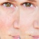 Антикуперозный тоник 250 мл Eldan Cosmetics / Элдан